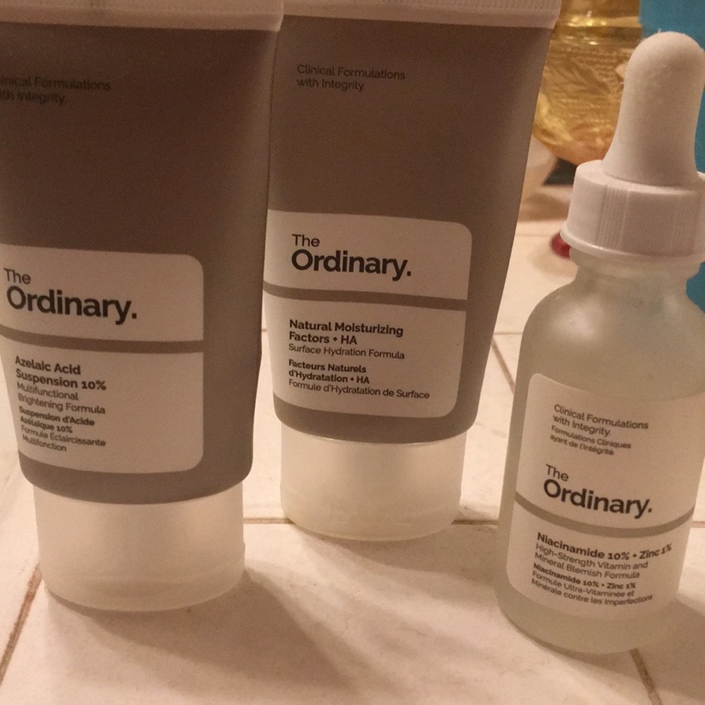 The ordinary bundle